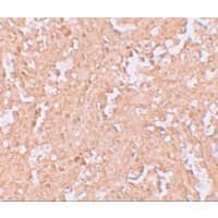 PD-L2 / PDCD1LG2 / CD273 Antibody