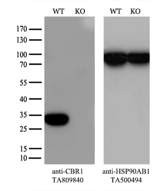CBR / CBR1 Antibody (clone OTI4B4)