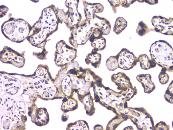 HDAC5 Antibody