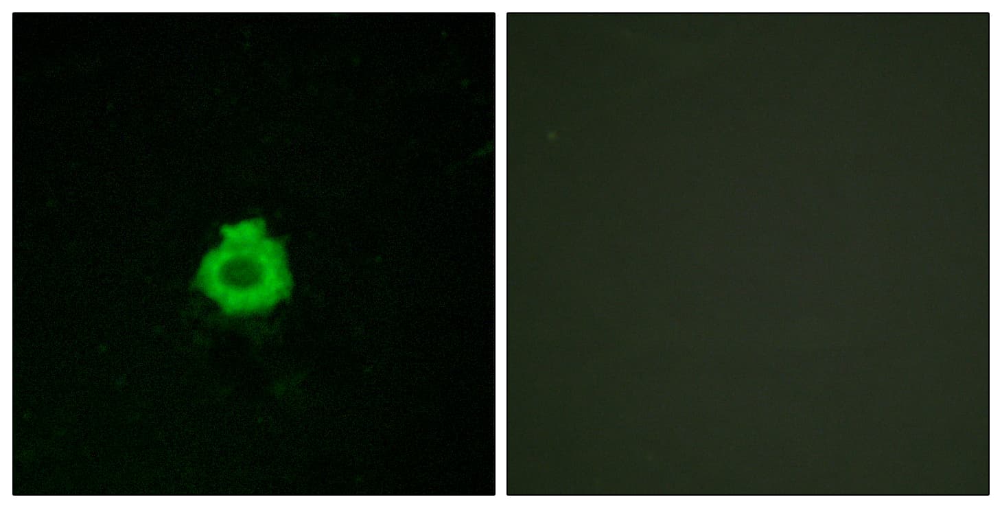 ADGRB2 / BAI2 Antibody (aa91-140)