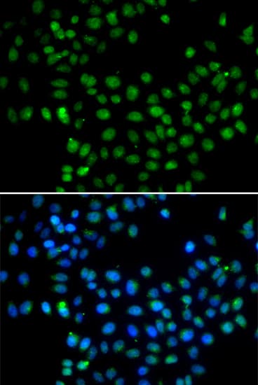 EAF2 / U19 Antibody
