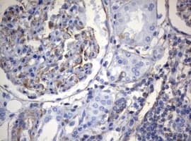 Monoclonal Mouse anti-Human Vimentin Antibody (clone OTI5D7, IHC, WB)