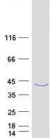 Human MAGEB2 Protein (Recombinant Myc-DDK (Flag))