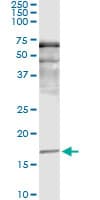 Monoclonal Mouse anti-Human SNCA / Alpha-Synuclein Antibody (clone 2E4, WB)