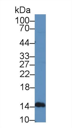 IFN Beta / Interferon Beta Antibody (aa23-169)