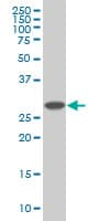 PSMD9 / 26S Proteasome Antibody (clone 3A4)