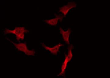 FASLG / Fas Ligand Antibody