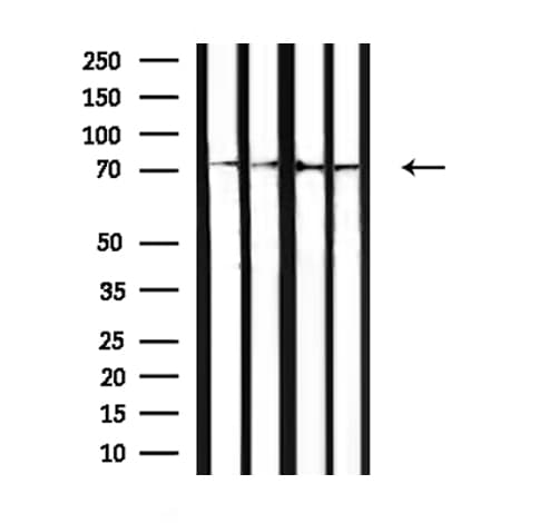 GARS / Glycyl tRNA Synthetase Antibody