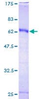 Human HOXC9 Protein (Recombinant GST)