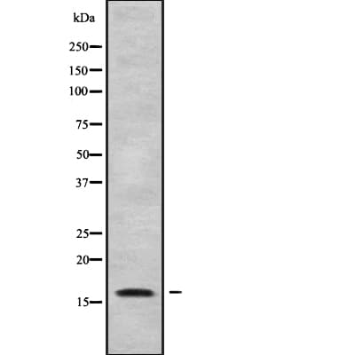 HBQ1 Antibody