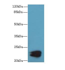 Polyclonal Rabbit anti-Human KRCC1 Antibody (WB)