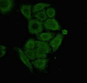 SSX1 Antibody