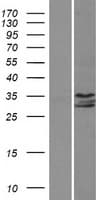 Human IP6K1 Protein (Over-Expression Lysate Myc-DDK (Flag))