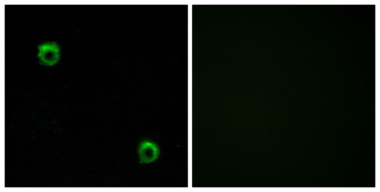FZD2 / Frizzled 2 Antibody
