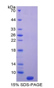 Rat T-Kininogen 1 Protein (Recombinant His)