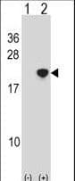 Polyclonal Rabbit anti-Human NANOS2 / NOS2 Antibody (aa58-85, WB)