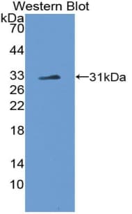 NOTCH4 Antibody (aa1690-1945)
