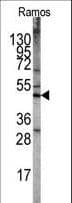 STK11 / LKB1 Antibody (aa19-48)