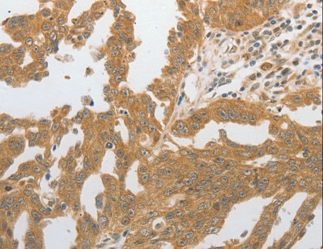 IHC-plus™ GRIN2C / NMDAR2C / NR2C Antibody