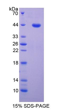 Human MAG Protein (Recombinant His-GST)