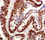 Recombinant Monoclonal Rabbit anti-Human MSH2 Antibody (clone RBT-MSH2, IHC)