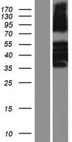 KRT81 / Keratin 81 / KRTHB1 Protein (Over-Expression Lysate Myc-DDK (Flag))