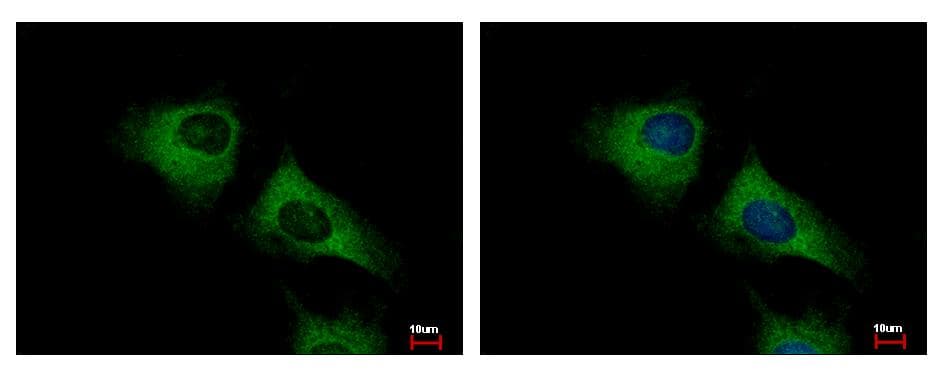 SCARA3 / APC7 Antibody (aa187-474)