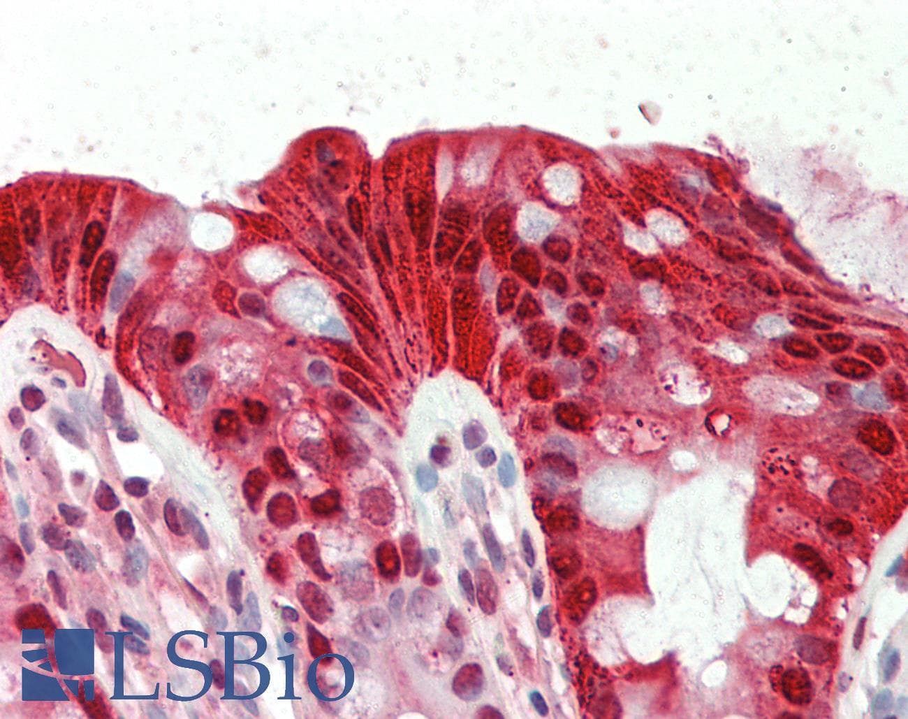 CA1 / Carbonic Anhydrase I Antibody (N-Terminus)