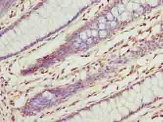 ILVBL Antibody
