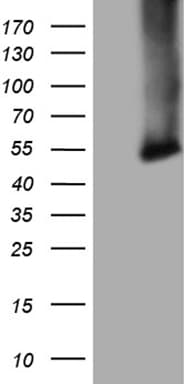 Monoclonal Mouse anti-Human CPM / Carboxypeptidase M Antibody (clone OTI4E11, aa124-423, IHC, WB)