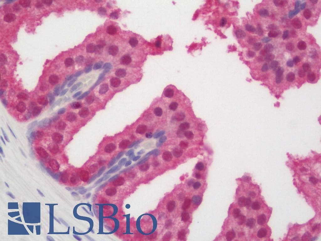 PathPlus™ IDH1 / IDH Antibody (aa116-143)