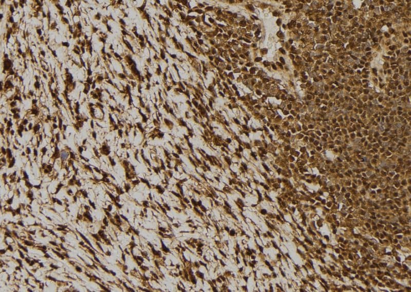 Polyclonal Rabbit anti-Human NDRG2 Antibody (IHC, WB)