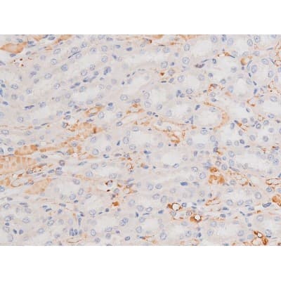 c-Kit / CD117 Antibody (phospho-Tyr703)