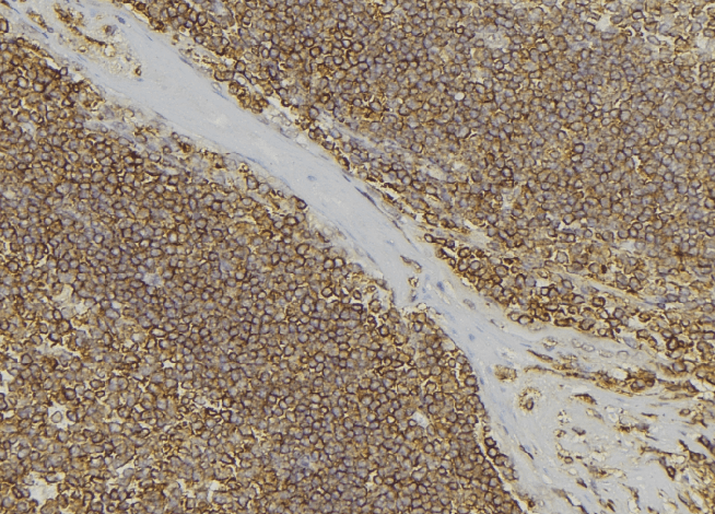 PABPC3 Antibody