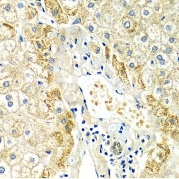 Polyclonal Rabbit anti-Human ERG Antibody (IHC, IF, WB)