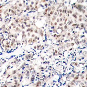 CDKN1B / p27 Kip1 Antibody (phospho-Thr187)