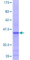 Human SOD2 / Mn SOD Protein (Recombinant GST)