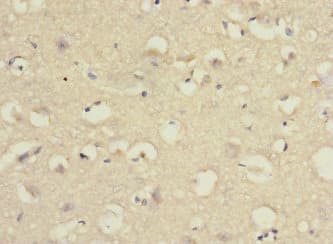 Polyclonal Rabbit anti-Human PCDH10 Antibody (IHC)