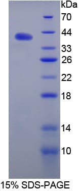 Mouse Angiostatin Protein (Recombinant His, N-Terminal)