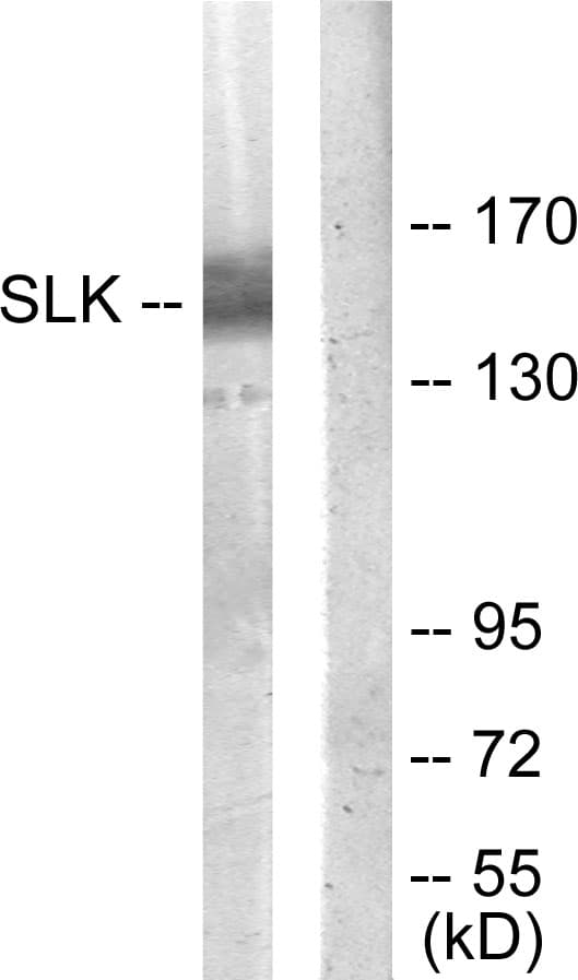IHC-plus™ SLK Antibody (aa1151-1200)