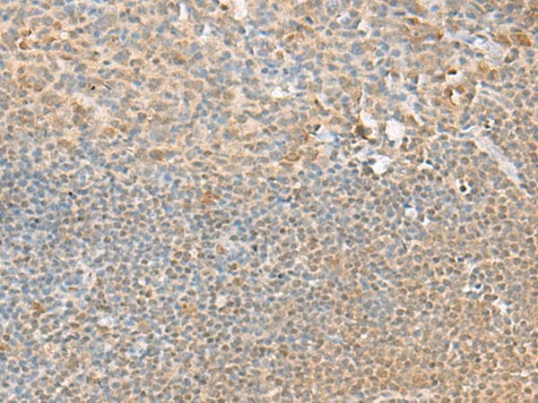 PSMD12 / Rpn5 Antibody