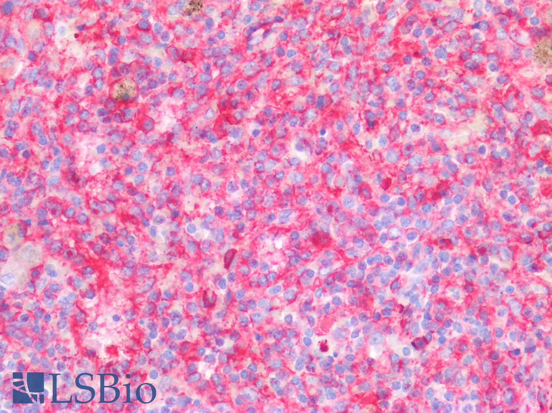 IHC-plus™ PECAM-1 / CD31 Antibody (clone OTI2C6)