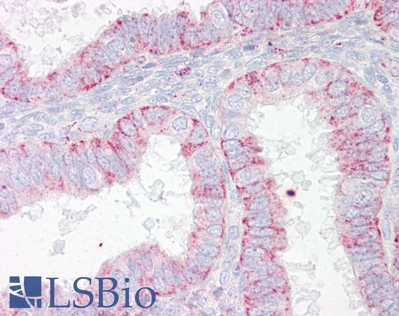 IHC-plus™ Polyclonal Rabbit anti-Human ABHD4 Antibody (aa251-300, IHC)