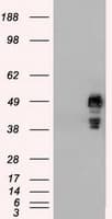 Monoclonal Mouse anti-Human SSB / La Antibody (clone OTI6G7, IHC, IF, WB)