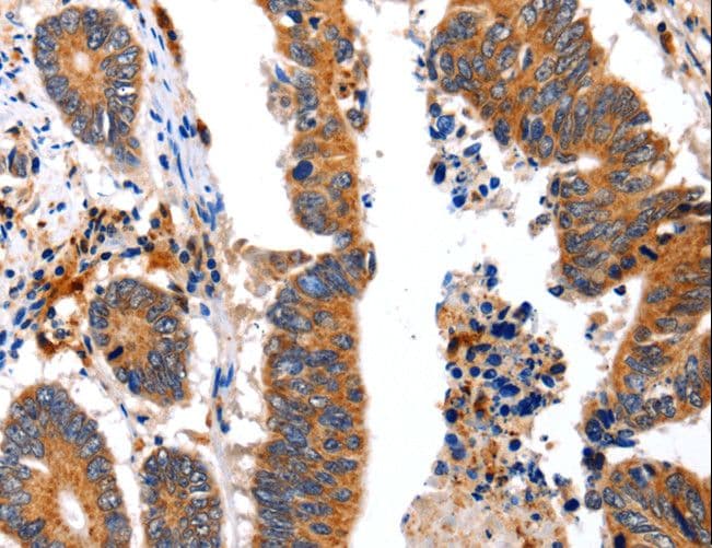 NCK1 / NCK Antibody