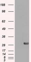 Monoclonal Mouse anti-Human SNAI1 / SNAIL-1 Antibody (clone OTI10D7, WB)