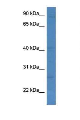 Polyclonal Rabbit anti-Human KLRC1 / NKG2A / CD159a Antibody (C-Terminus, WB)
