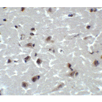 Polyclonal Rabbit anti-Human CD81 Antibody (IHC, IF, WB)