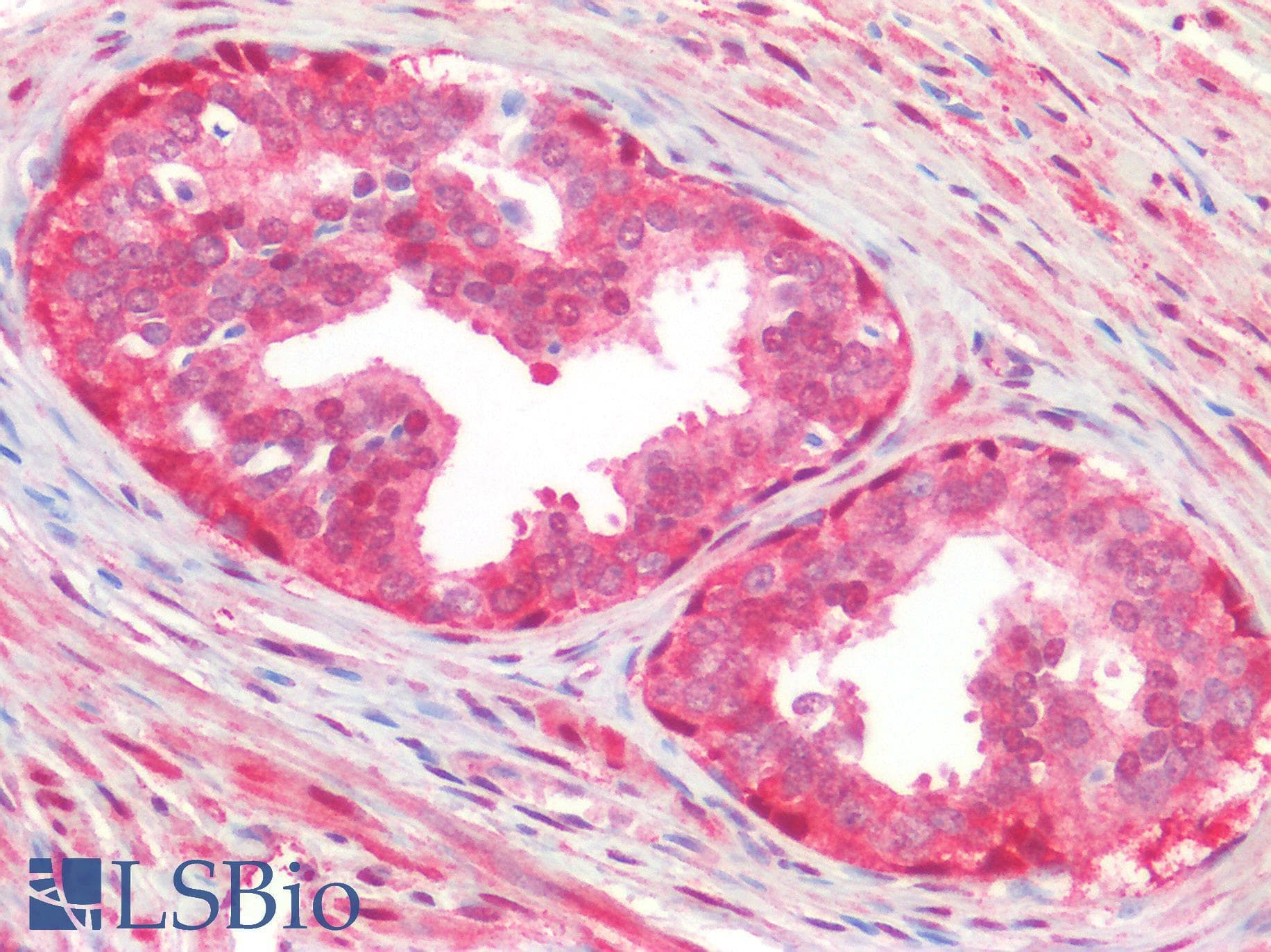 YAP / YAP1 Antibody