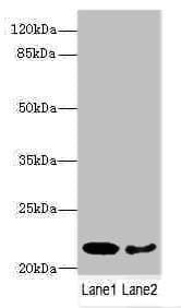 PRDX2 / Peroxiredoxin 2 Antibody
